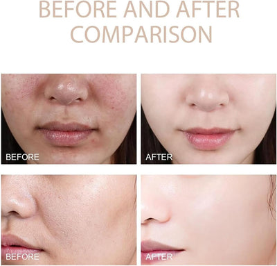 PHANSTA™ Purifying Peeling Gel (Buy 1 Get 1 Free)