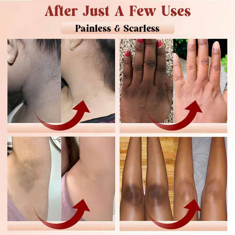 PHANSTA™ Purifying Peeling Gel (Buy 1 Get 1 Free)